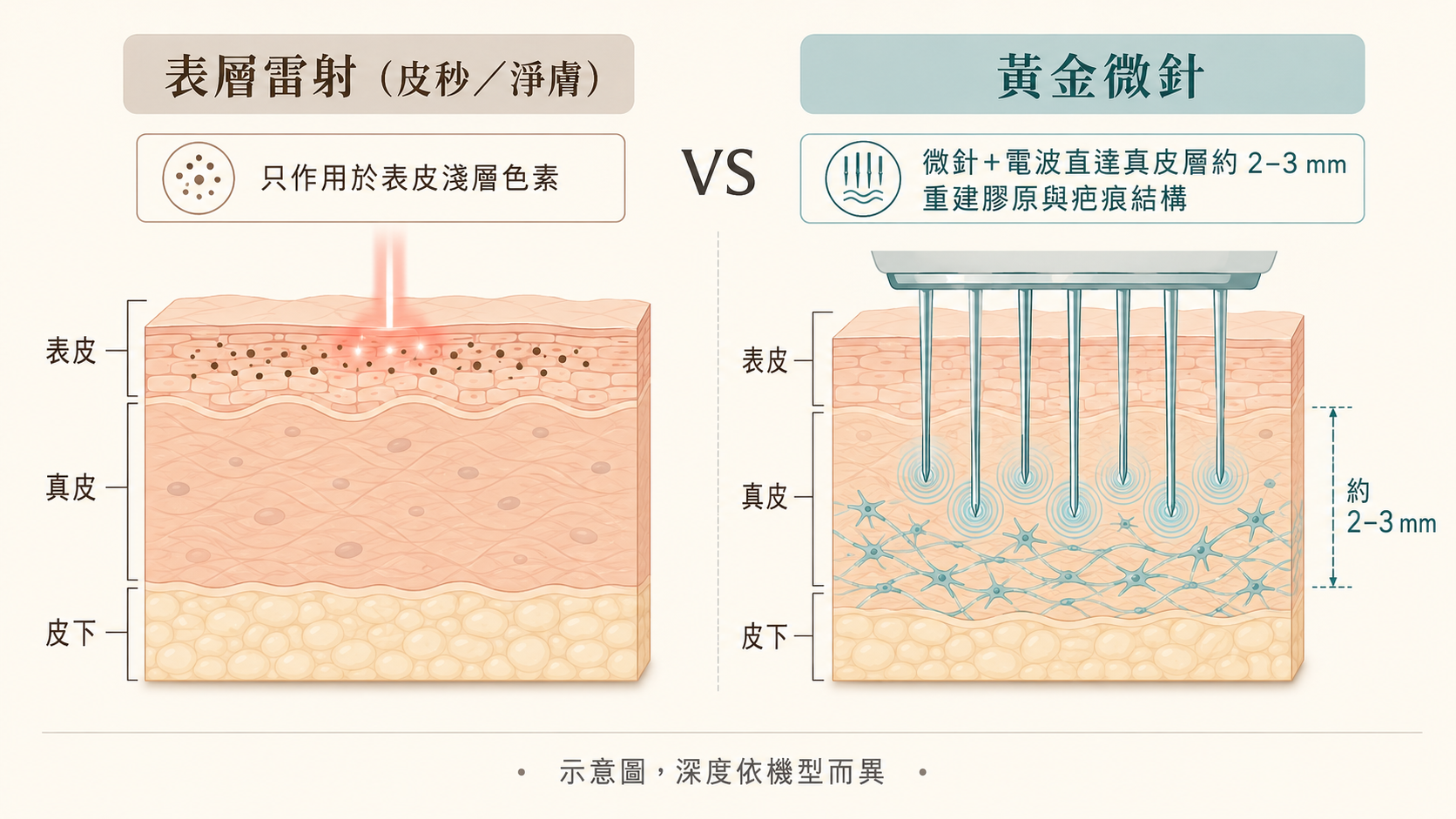 皮秒VS黃金微針