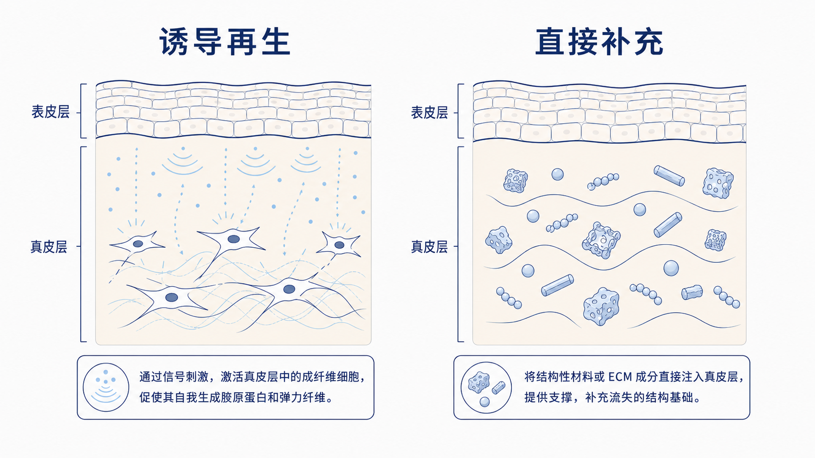 诞生注射VSRe2O