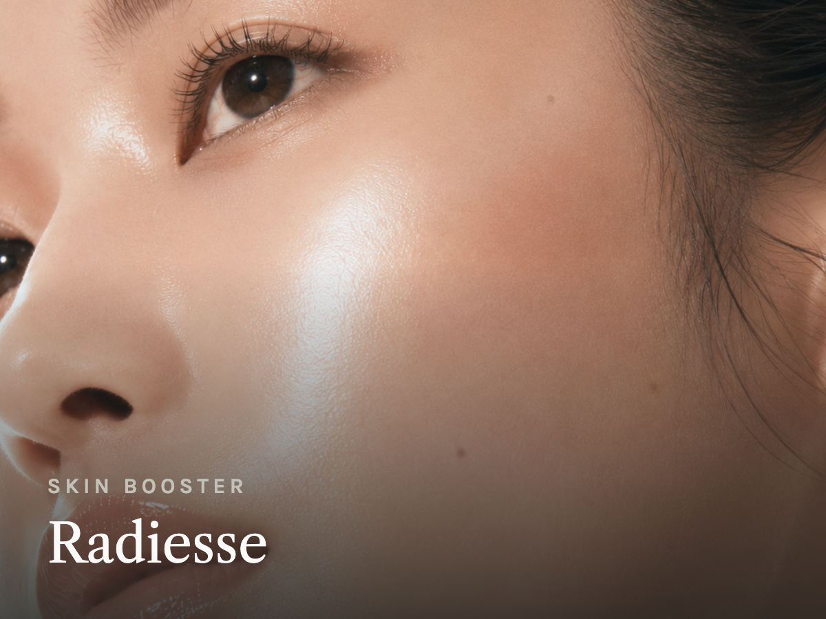 Radiesse