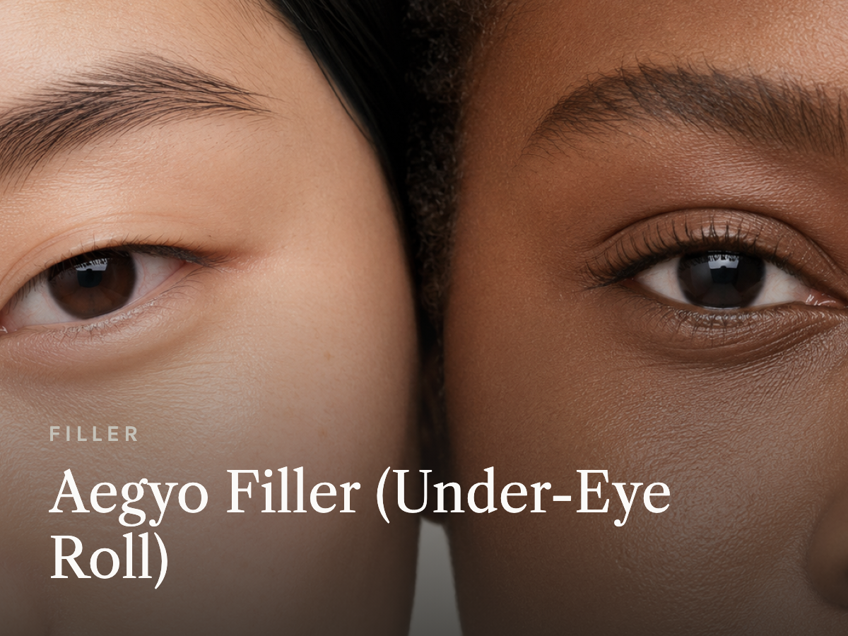 Aegyo Sal Filler (Under-Eye Roll)