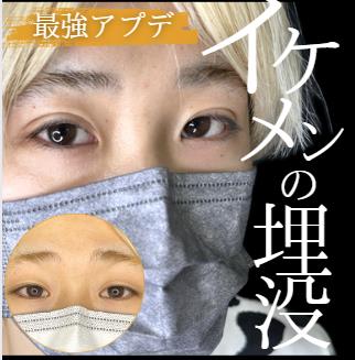 双眼皮手术