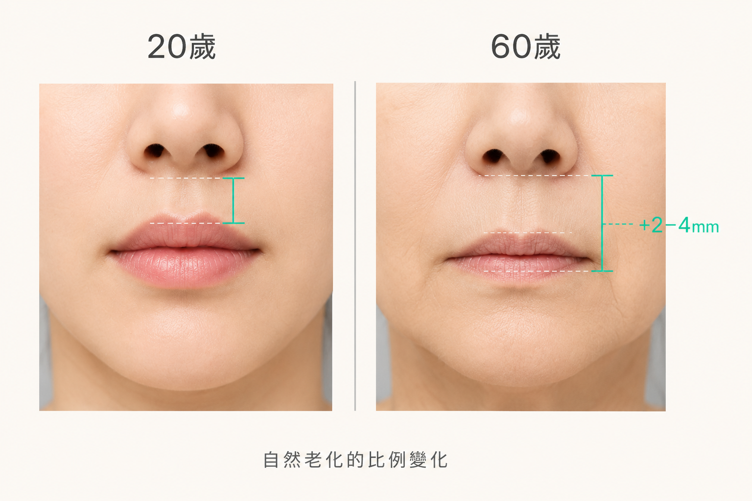 人中長度差異