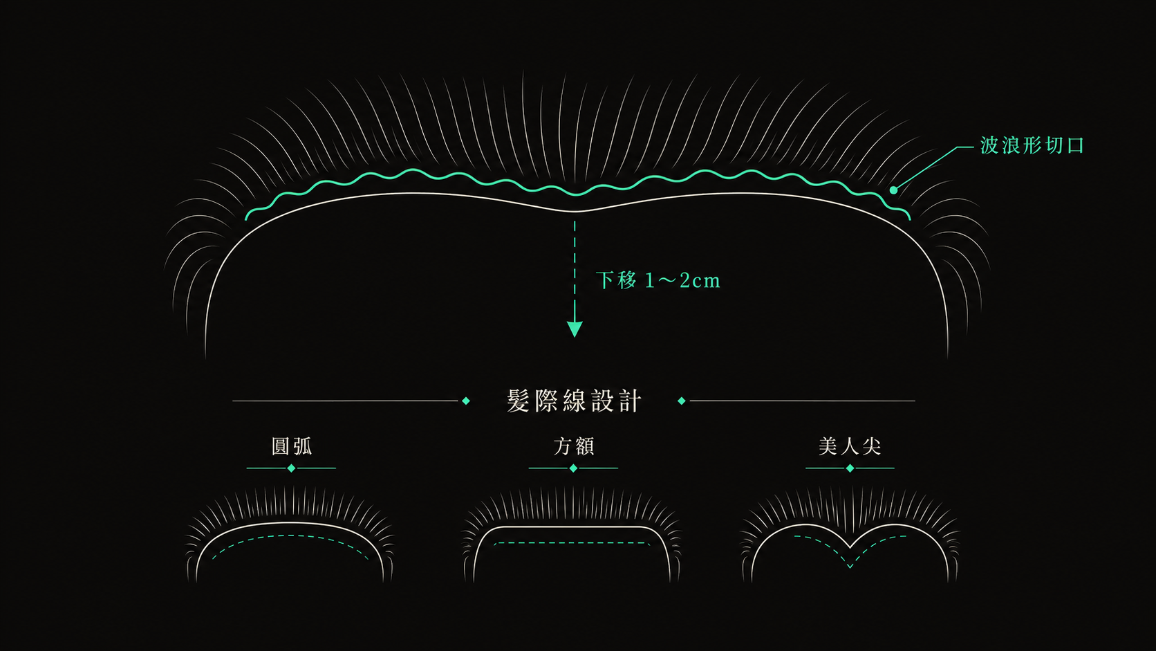 髮際線設計