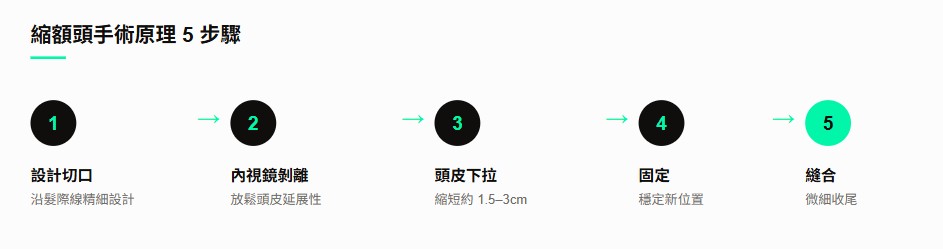 什麼是縮額頭手術？原理一次看懂