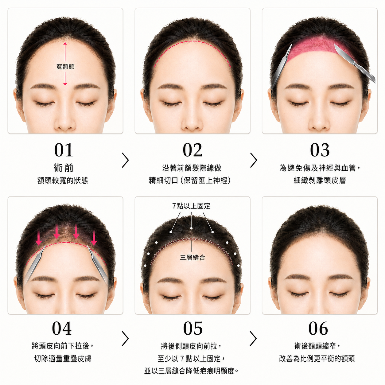 精準到 1mm 的設計與技術