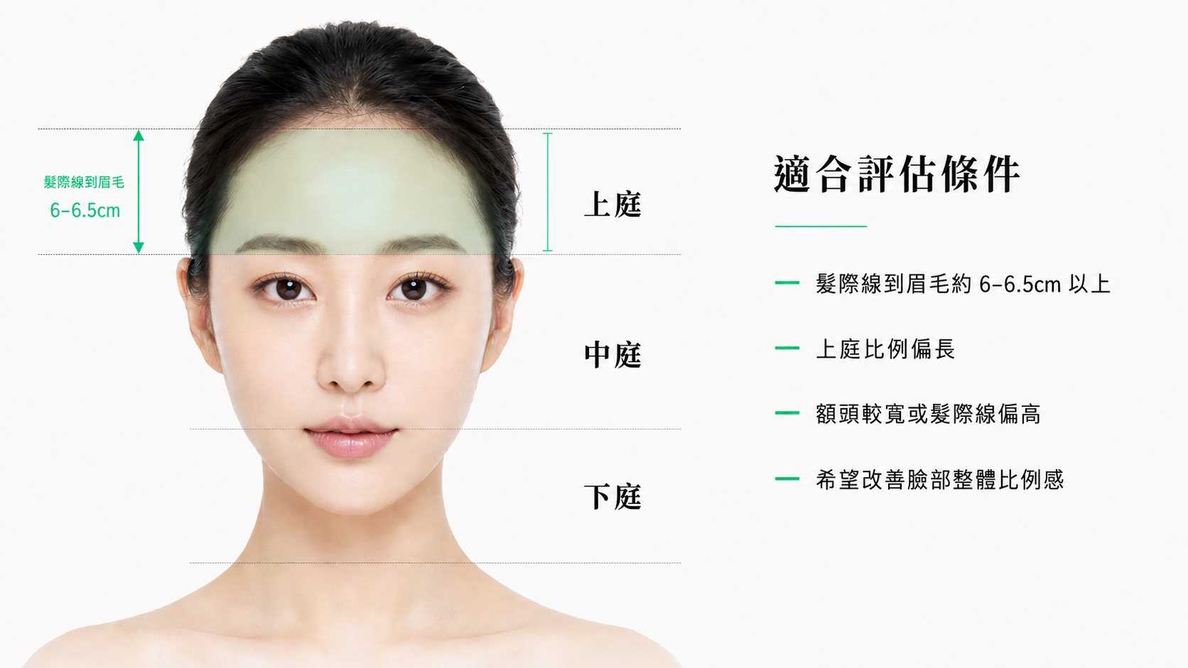 我適合做縮額頭手術嗎？適合對象與三庭比例