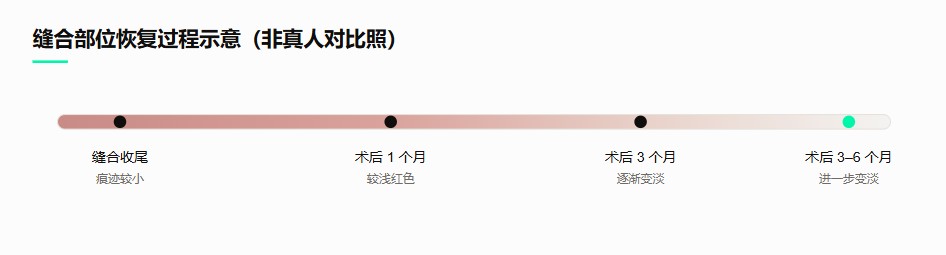 恢复过程示意