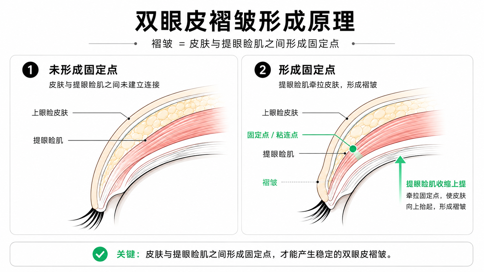 做出一条褶皱