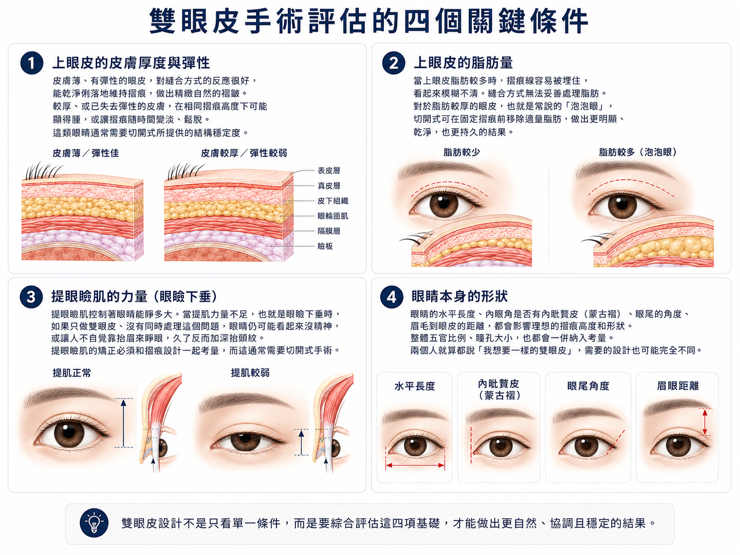 決定一切的四個眼睛條件