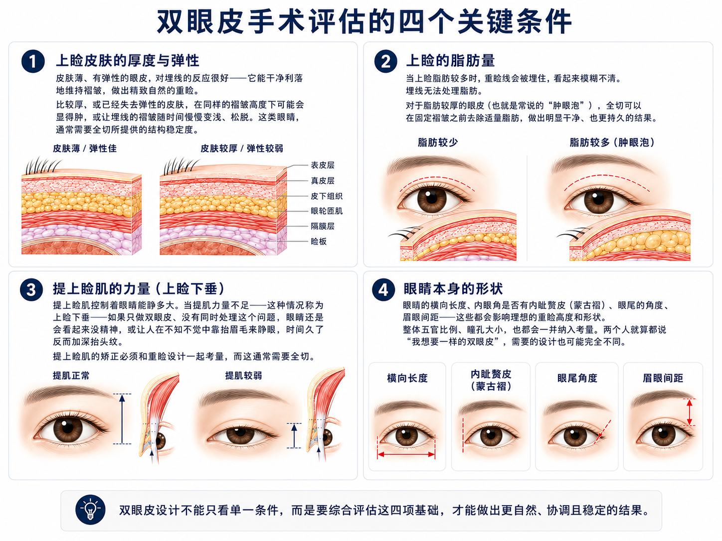 决定一切的四个眼睛条件