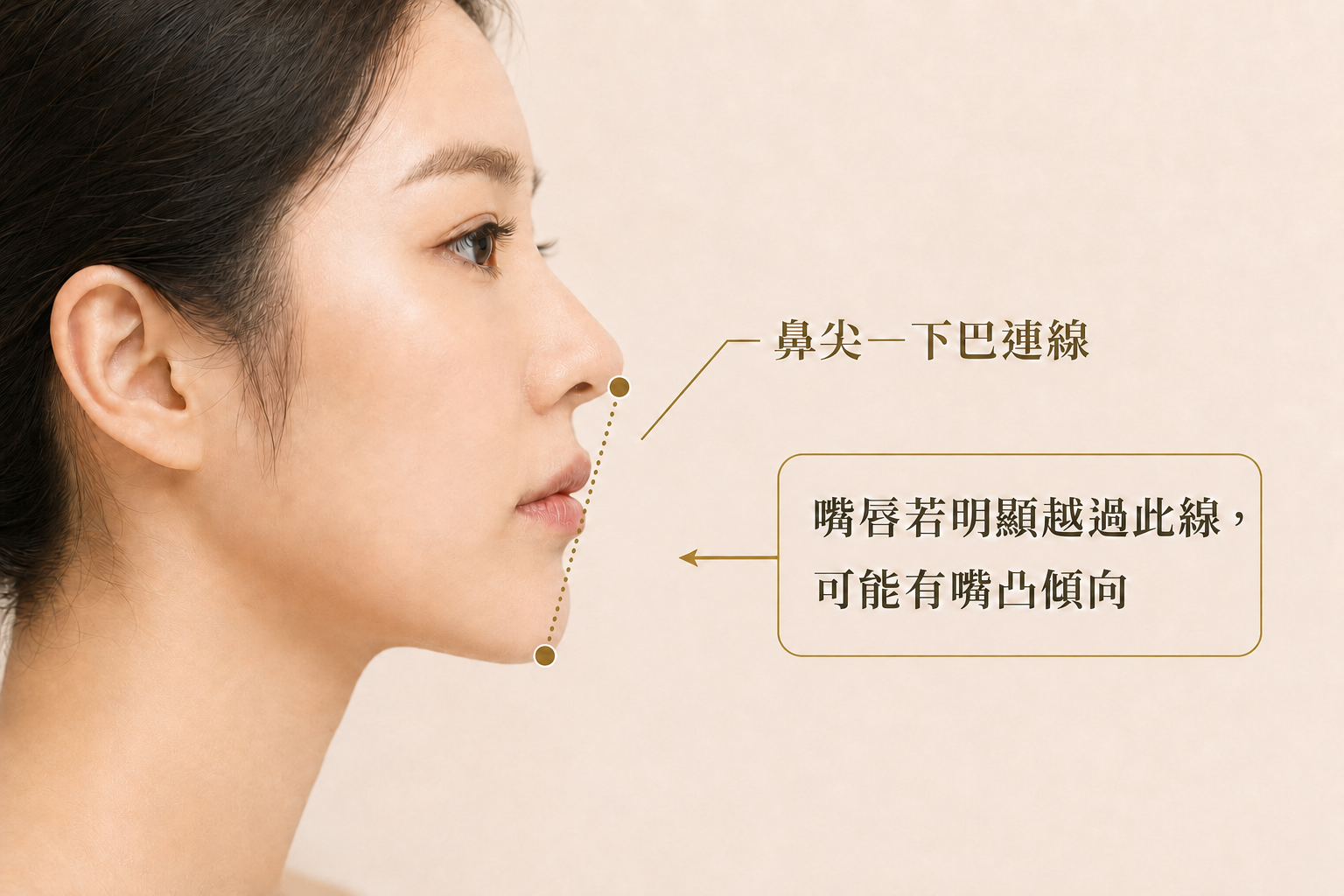 你適合這個手術嗎？