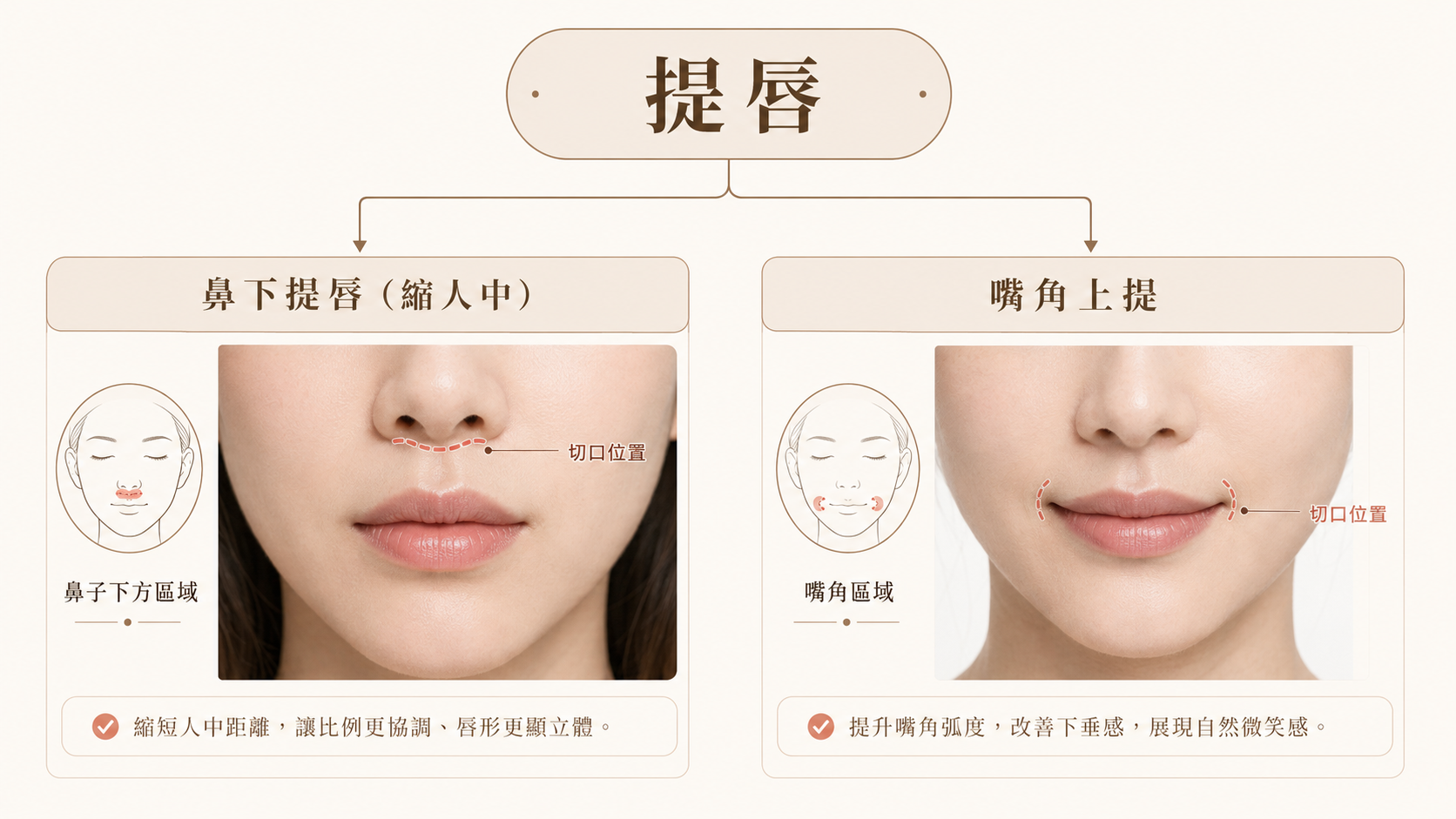 但「提唇」不只一種