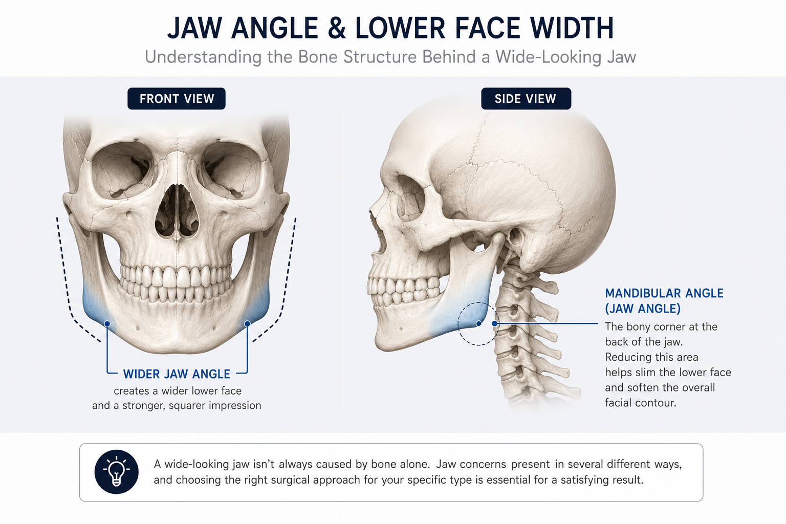 jaw-reduction-anatomy