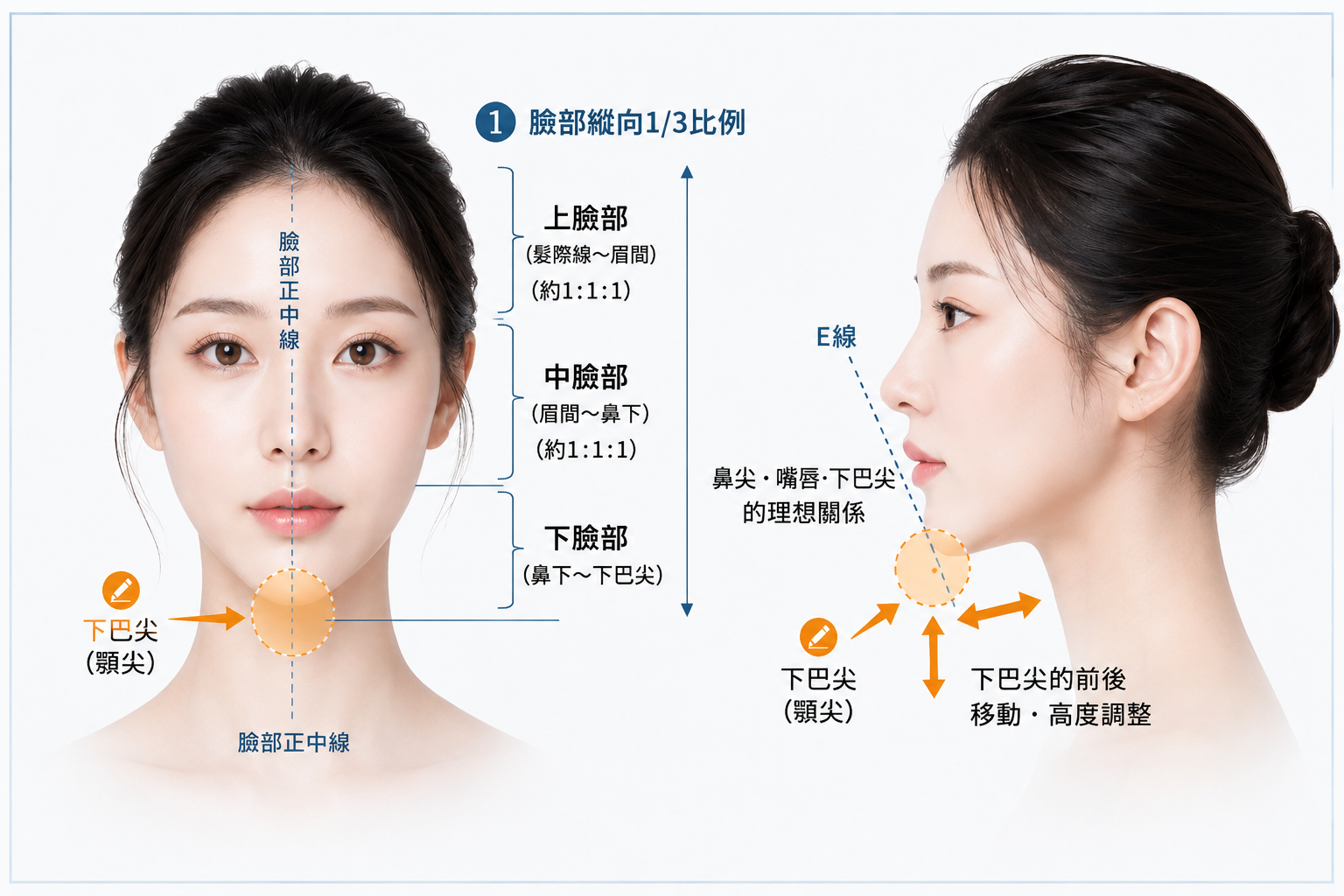 說明下巴截骨是什麼——標示下巴尖位置與理想臉部平衡的解說圖