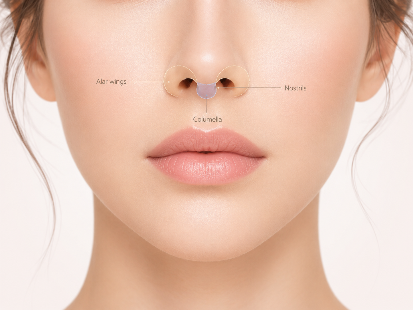 how a lip lift can affect the nostrils and alar base