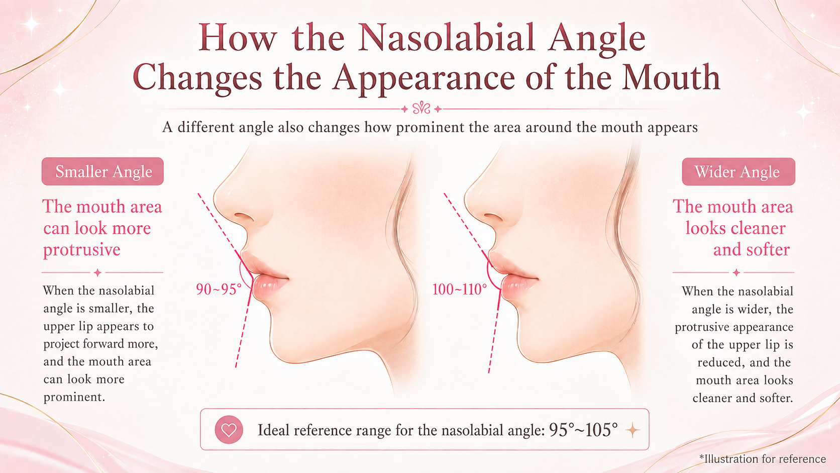 Illustration showing how the nasolabial angle changes how protruded the mouth appears