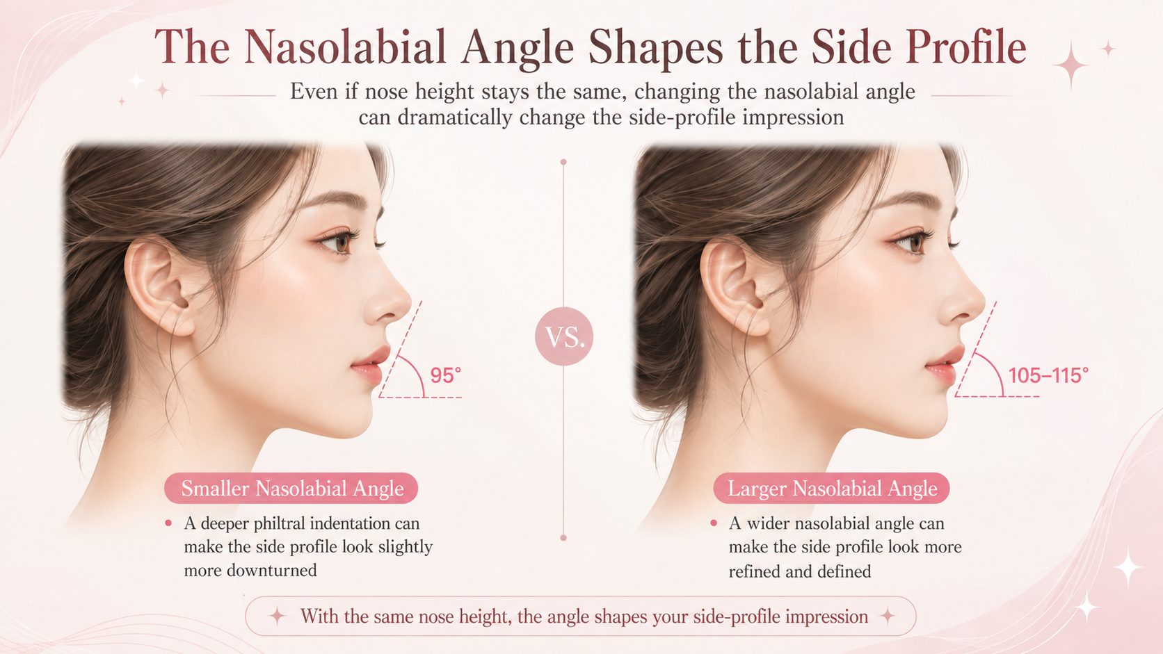 profile comparison showing the difference between Philtrum-Nose and standard rhinoplasty