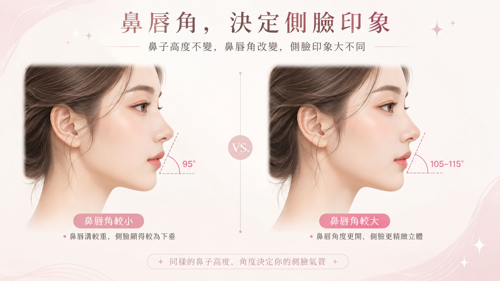 呈現人中鼻與一般鼻整形差別的側臉比較示意圖