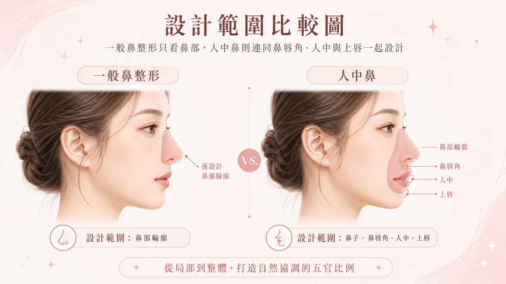 一般鼻整形與人中鼻設計範圍差別的比較圖