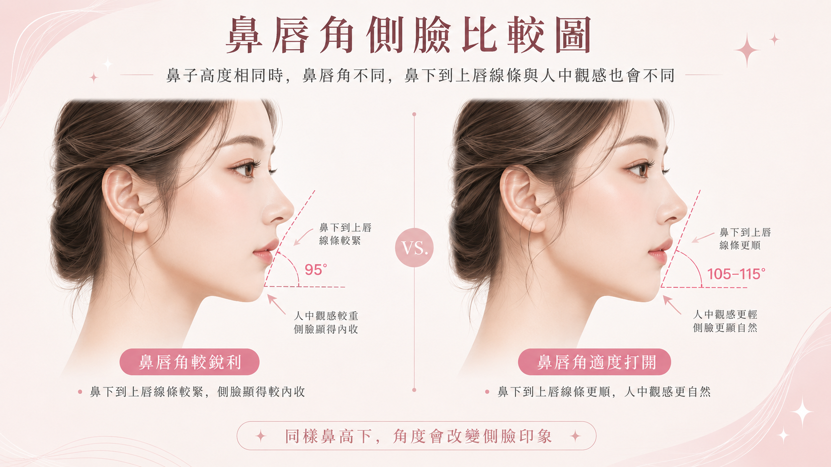 鼻子高度相同但鼻唇角不同時側臉印象差異的比較圖